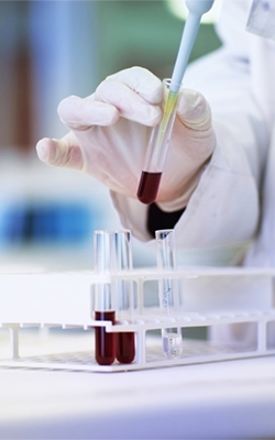 NOX gas detectors for laboratory analysis